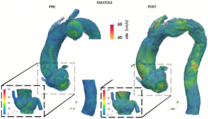 Ruggeri-et-al-SimulationAorta-LIVE-Lab-UniPV